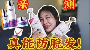 爆料网红掉头发视频下载,揭秘掉发背后的真相与预防方法 第3张 爆料网红掉头发视频下载,揭秘掉发背后的真相与预防方法 第3张